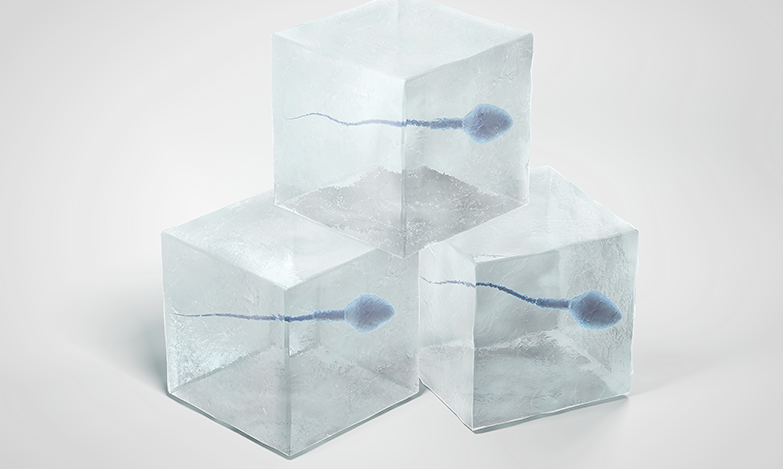 Κρυοσυντήρηση Σπέρματος