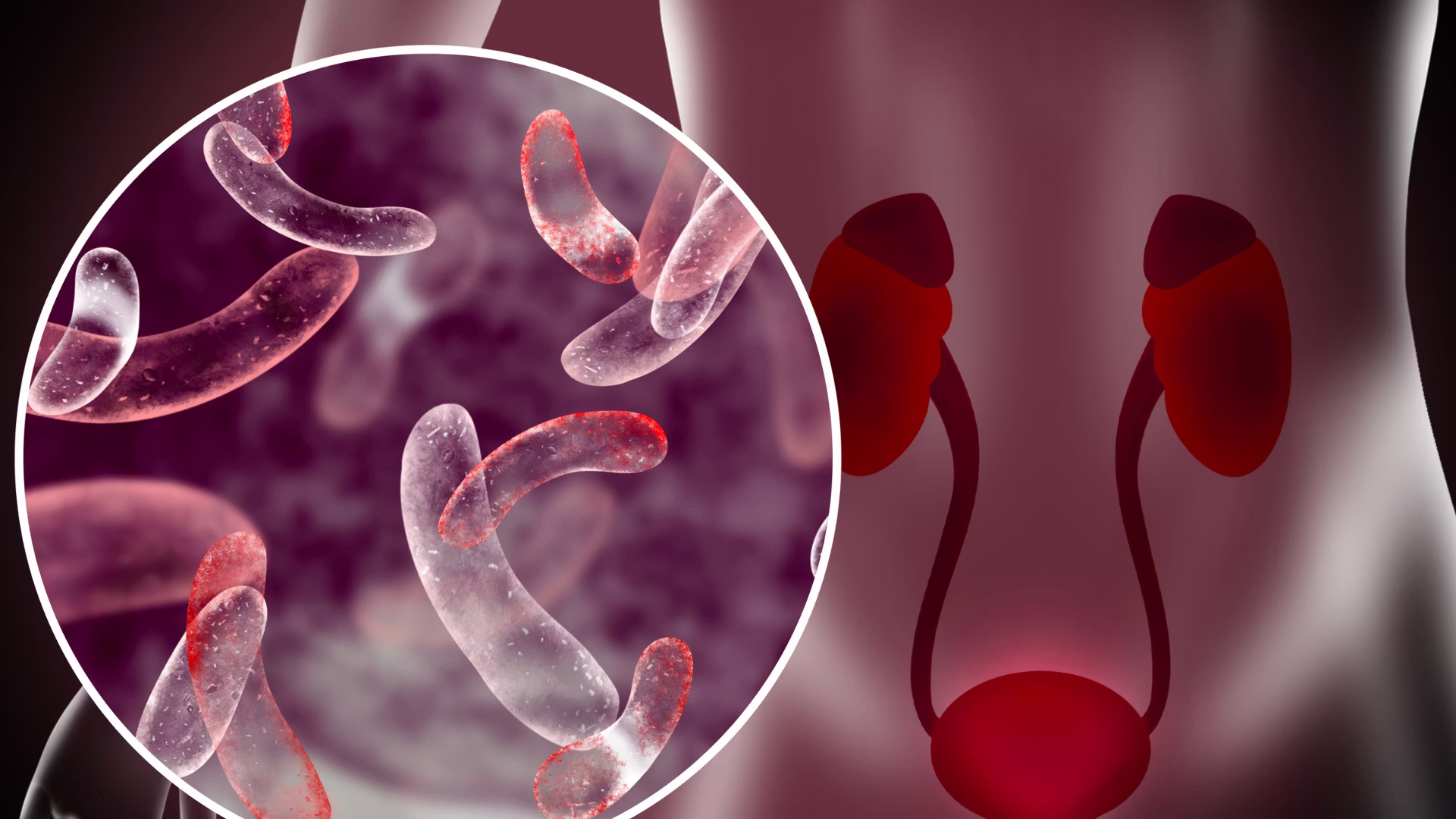 Out‑of‑the‑Box Προσέγγιση για Ουρολοιμώξεις: Από τη Νέα Κατηγοριοποίηση μέχρι Μη‑Αντιβιοτικές Θεραπείες